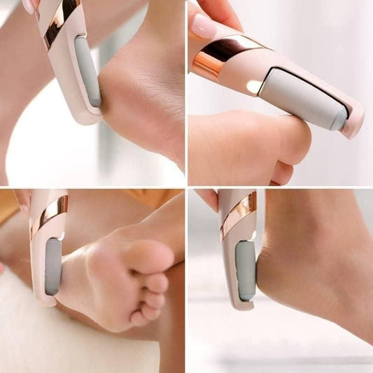Electronic Cordless Dead Skin Remover